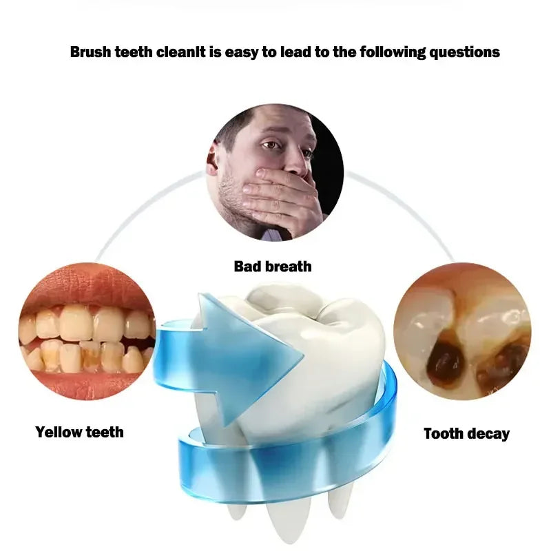 Cepillo de dientes eléctrico sónico tipo U, cabezal de silicona, 360 grados, inteligente, carga USB automática, resistente al agua, blanqueador dental.